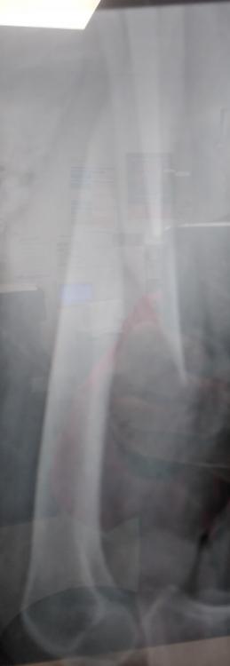 Greta Leg.jpg