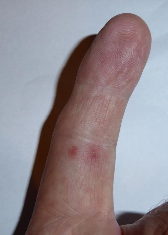 1174697280_Snakebite.thumb.JPG.5e5264285a4c394467e768a2af1271d1.JPG